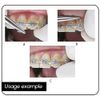 BELEON Braces Wire Orthodontic Dental Ligature Wire for Braces for Home Use Stainless Steel 40g 0.25mm