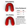 Venum Challenger Mouthguard - Strap/Strapless