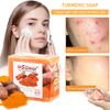 2PC Turmeric Soap Bar for Face & Body-Tumeric Soap,Acne, Dark Spots, Smooth Skin