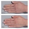 Perricone MD Cold Plasma Plus+ Hand Therapy