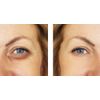 BESHA INC Verisol Collagen Bioactive Peptides (Natural Collagen Powder) Made in Germany - 2 Month Supply