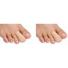 PediFix Visco-gel Toe Protector, Large, (Pack of 2)