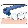 Tepe Angle Brush Interspace medium