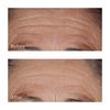 Perricone MD High Potency Classics Hyaluronic Intensive Hydrating Serum, 2 oz.