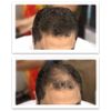 Caboki Value Pack 4 (Dark Brown)