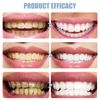 Nobs Toothpaste Tablets - 2 Boxes Hydroxyapatite, Environmentally Friendly and Travel-Friendly