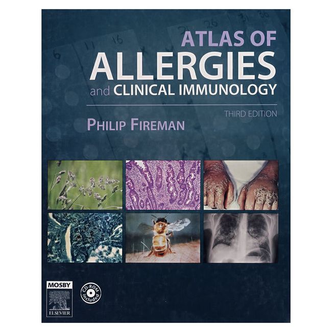 过敏症与临床免疫图谱（第3版）Atlas of Allergies and Clinical Immunology