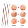Blackhead Pimple Spot Popper Blemish Comedone Tool Acne Extractor Remover Kit