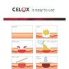 Celox First Aid 5pk Traumatic Wound STOPS Bleeding Fast Bandage Kit 2g Exp2026