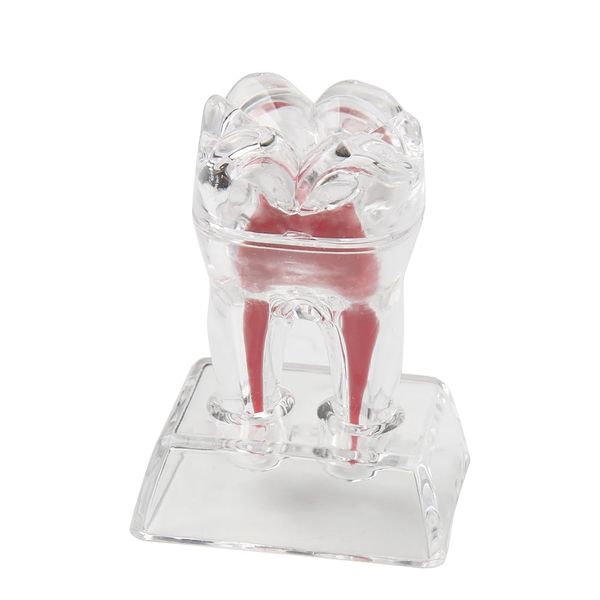 Dental Model Removable Transparent Tooth Anatomical Model Detachable Single Tooth Structure Decomposition Molar Model Dentistry Demonstration Models