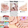 Fungal Nail Treatment for Toenails Extra Strong,Nail Fungus Treatment for Toenail,Toenail Fungus Treatment,Nail Repair for Fingernails Toenails,Strengthen Renew Damaged, Broken Nails