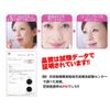 Nose Mask Pit, Size R, 14 Pieces