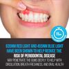 Starlite Smile Gum Light, 32 LED Red & Blue Light Gums Sensitive Support and ...