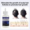 4Pack Minoxidil 5% Extra Strength Hair Regrowth Solution 4 Month Supply For Men