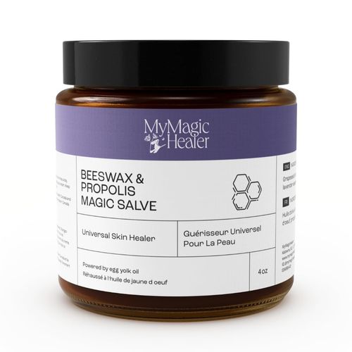 Beeswax & Propolis Magic Salve | Boils & Infected Cyst Treatment | Cystic Acne | Hidradenitis Suppurativa Abscesses | Pulls Out the Pus | Relieves Skin from Pain and Discomfort (4 oz)