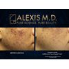 Bi-Weekly Scrub | 100ml | 3.3oz
