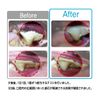 Denti Three Fairy EX Small 14pcs