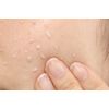 Kore Nadeshiko Moisturizing Peeling, Exfoliating Plug, Dullness, Poroporo Peeling Gel, 6.8 fl oz (200 ml)