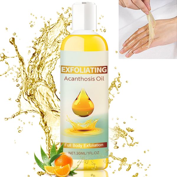 Exfoliating Acanthosis Peeling Oil,Exfoliation Body Oil,Peeling Solution Skin Peel Dark Spot Corrector Oil,Yellow Peeling Oil, Body Skin Care Exfoliation Oil Dark Spot Remover For Body Hand Feet