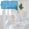 McKesson 2% Miconazole Nitrate 4 Oz Tube