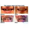 Instant Smile MULTISHADE Patented Temporary Tooth Repair Kit. A Realistic Looking Fix for a Missing or Broken Tooth.
