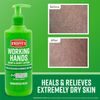 O'Keeffe's Working Hands Hand and Body Lotion - 12 oz Pump (1 Pack) -...