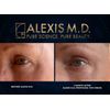 ALEXIS M.D. Moisturizing Cleanser | 100ml | 3.3oz