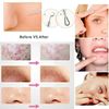 9 PCS Blackhead Remover Pimple Tool Kit Acne Comedone Extractor Tweezer & Needle
