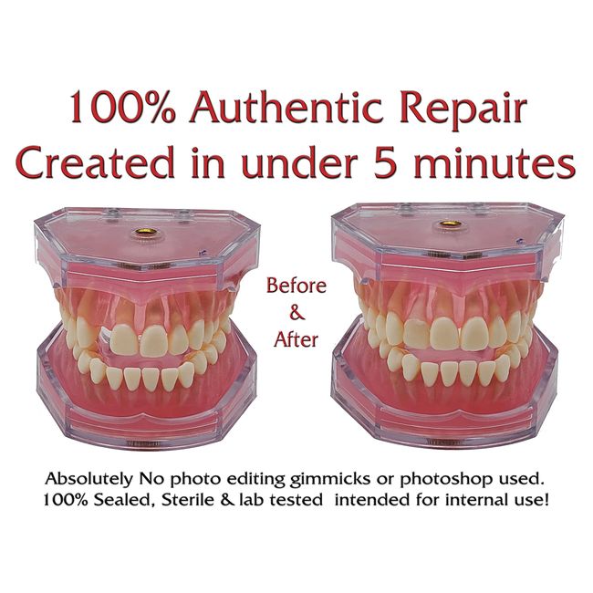 Temporary Tooth Repair Kit Dental Repair Replace Missing Broken