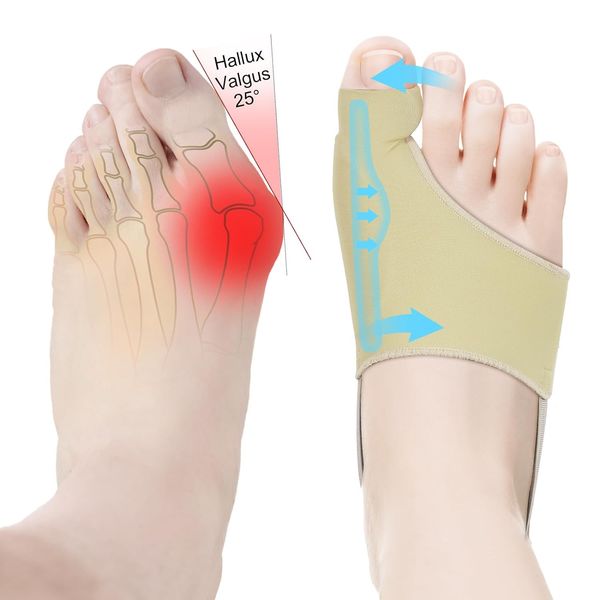 2 Pcs Bunion Corrector for Women & Men, Non-Surgical Bunion Socks Toe Corrector