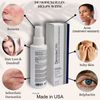 Demodexcillin Skin Solution 4 Fl.Oz Recommended For Acne, Rosacea, Blepharitis