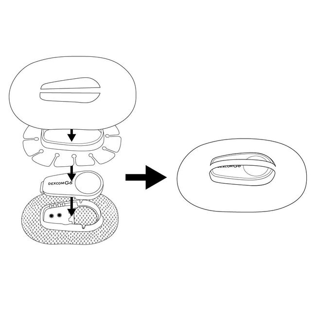 Flexible & Reusable Cover and x10 Patches Compatible with Dexcom