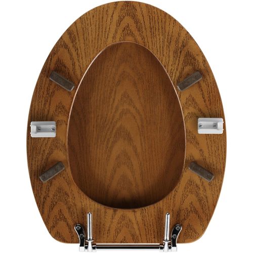 SteadySeat Quick & Easy fix for Loose or Wobbly Seats, seat stoppers buffers, No Tools Necessary. Now Includes Sticky Pads and Screws/Pilot Holes to Attach More Easily to More Toilet Seats