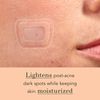 Rael Pimple Patches, Miracle Microcrystal Spot Cover - Dark Spot Corrector, Hydrocolloid, Post Acne, with Skin Brightening, for All Skin Types, Vegan, Cruelty Free (6 Count)