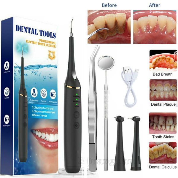 Electric Tooth Cleaner Dental Tools Plaque Calculus Remover Teeth Cleaning Kit