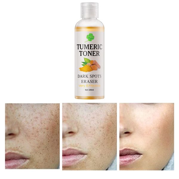 Toner for Dark Spots Turmeric Dark Spot Corrector Toner, Facial Toner for Acne Prone Skin, Dark Spot Remover for Face Hydrating Face Toner for Women, Hyperpigmentation Treatment for Dry Oily Skin 4OZ