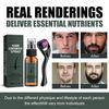 Beard Growth Set with Titanium Derma Roller, Beard Roller Kit 30 ml, Beard Roller Beard Growth Serum Oil, Beard Growth Roller, Beard Microneedle, Beard Care Set Best Gift for Men