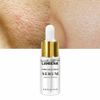 3 pack Pore Shrinkage Liquid Remove Blackhead Whitehead Acne Cleansing Whitening