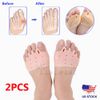 2PCS Silicone Bunion Toe Corrector Orthotics Straightener Separator Forefoot Pad