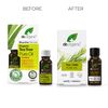 Tea Tree Pure Oil 10ml