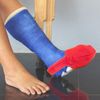 LimbO Toe Cozy for Leg Casts (Blue, Shoe Size 8-14)