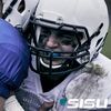 3D Mouth Guard