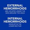 (2 pack)Equate Hemorrhoidal Ointment, Relief from Burning, Itching - Hemorrhoids
