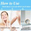Purederm Trouble Clear Spot Patches 5 Pack
