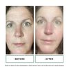 Replenix Age Restore Retinol Eye Repair