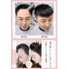 YOYO Partial Wig, Hairline, Hair Lines, Extra Thin, 100% Human Hair, Hair Implant, Men's, Hair Piece, Excellent Breathability, Super Natural, High Forehead, Bangs Wig, For Medical Use, Thin Hair Shedding, Circular Alopecia, Hair Loss Concealment, Hair Ext