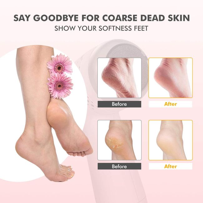Electric Callus Remover For Feet Foot Sandpaper Pedicure Dead Skin Remover  NEW