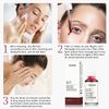 AHA 30% + BHA 2% Peeling Solution, Exfoliating AHA 30% BHA 2% Peeling Solution Anti Acne Serum, Chemical Peel for Face at Home, BHA AHA Mask Red Peel, BHA Liquid Exfoliant for Blemishes Wrinkle-1 Floz