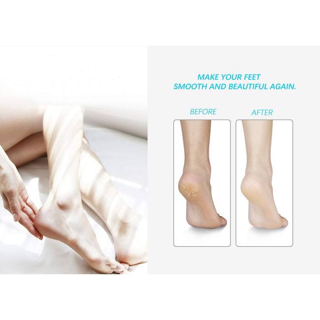Beauty by Earth Foot File - Callus Remover Tool for Dead Skin
