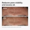 THE ORDINARY Niacinamide 10% + zinco 1%, 30 ml
